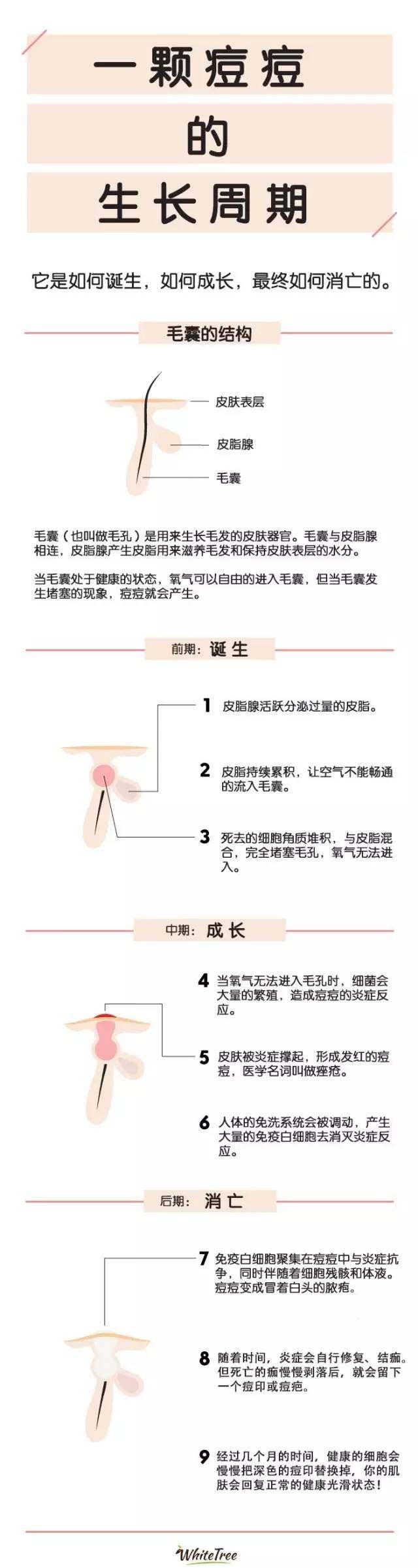 长痘原因
